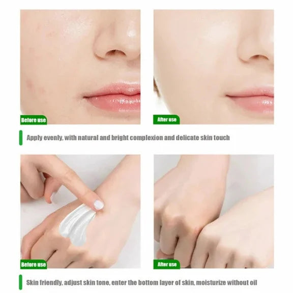 Body Whitening Cream [ Private Parts Underarm Bleaching Serum Armpit knees Elbows Areola Nipple Neck Lips Dark Spot Beauty Care]